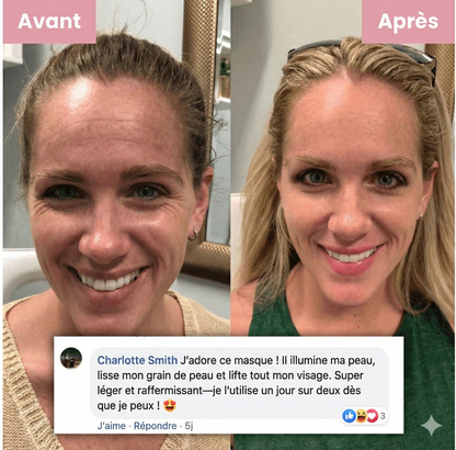 Collagène Nuit Activator Hoygi Masque exfoliant ™