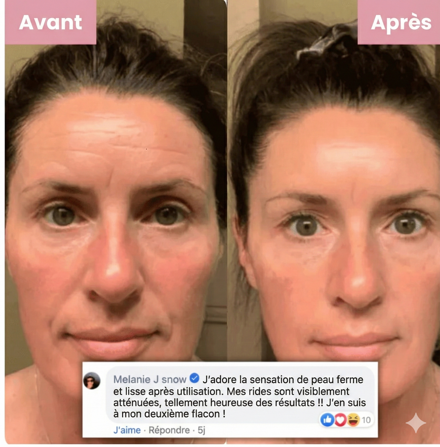 Collagène Nuit Activator Hoygi Masque exfoliant ™