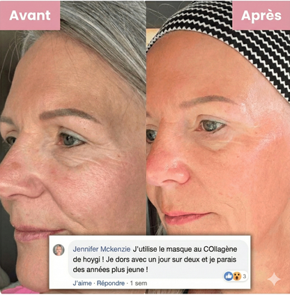 Collagène Nuit Activator Hoygi Masque exfoliant ™