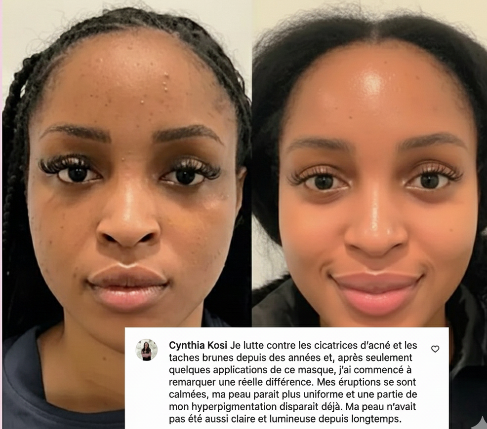 Collagène Nuit Activator Hoygi Masque exfoliant ™