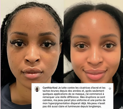 Collagène Nuit Activator Hoygi Masque exfoliant ™